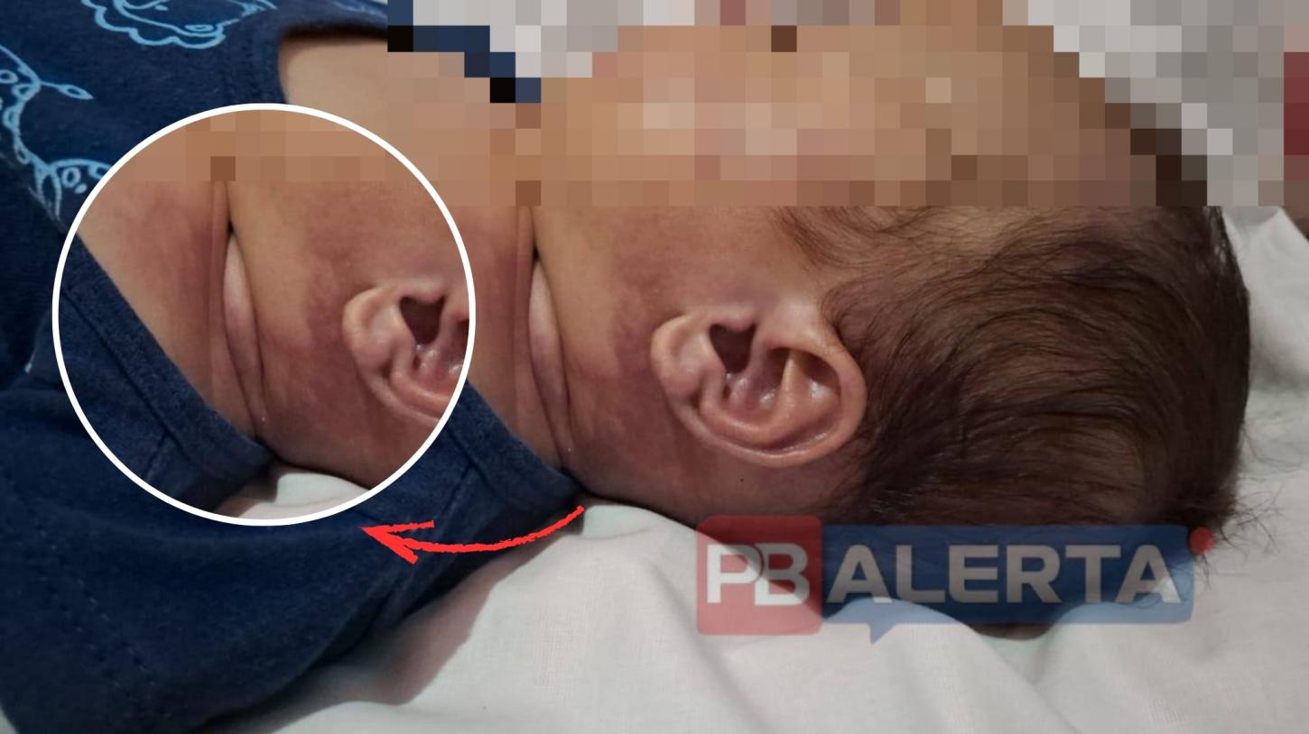 Bebê de dois meses é encontrado morto com sinais de lesão no pescoço em Monte Horebe